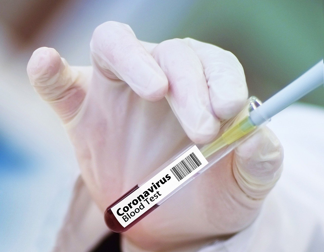 ¿Tendremos una vacuna contra el coronavirus para los 50plus?